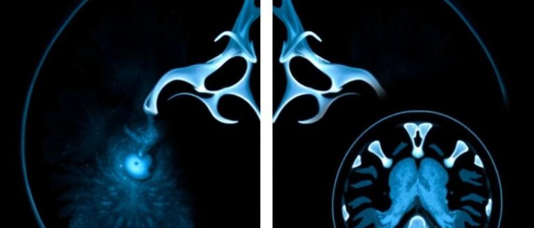 МРТ и КТ: увидеть тело изнутри — что и когда выбрать