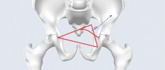 Анатомия бедренного треугольника: что скрывается в глубине средней части бедра